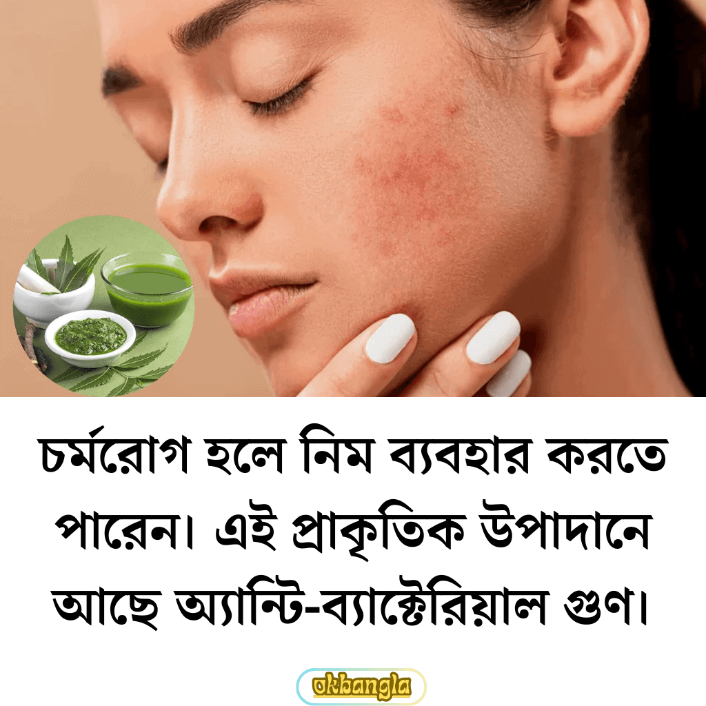 চর্মরোগের ঘরোয়া চিকিৎসা