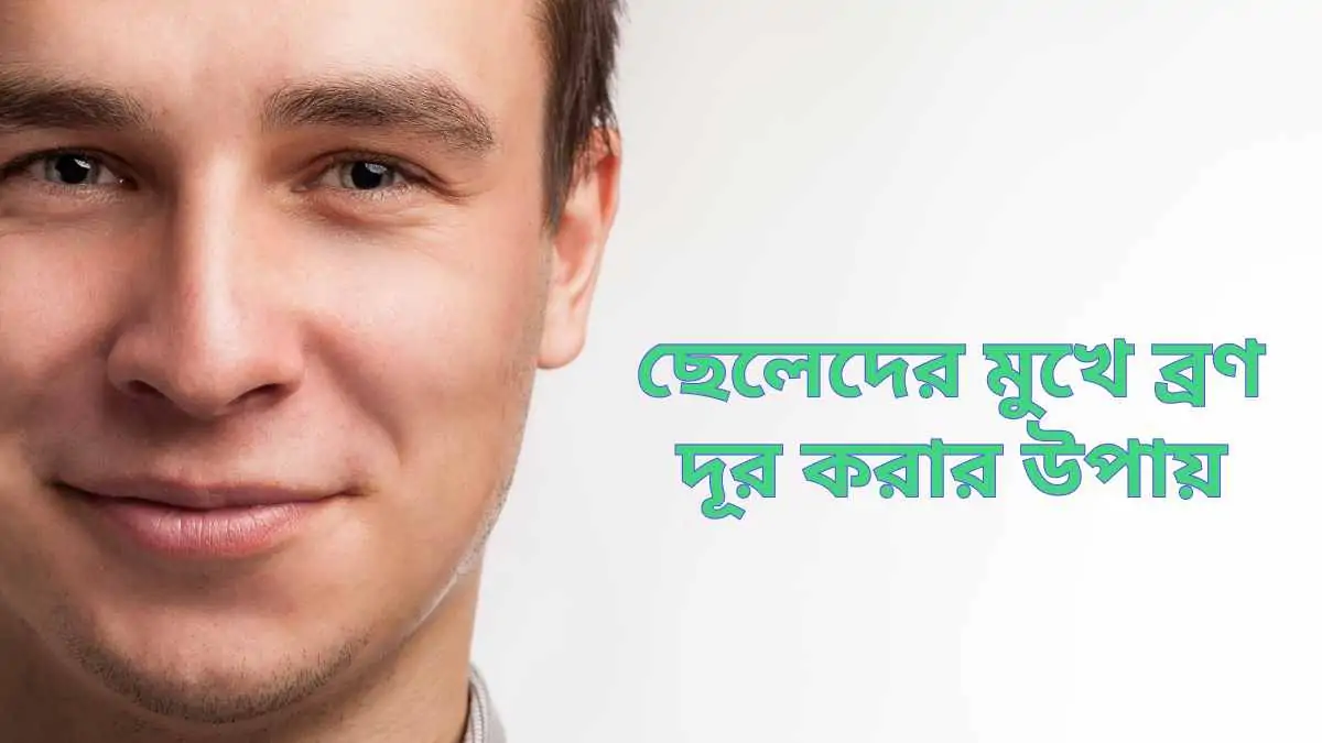 ছেলেদের-মুখে-ব্রণ-দূর-করার-উপায়