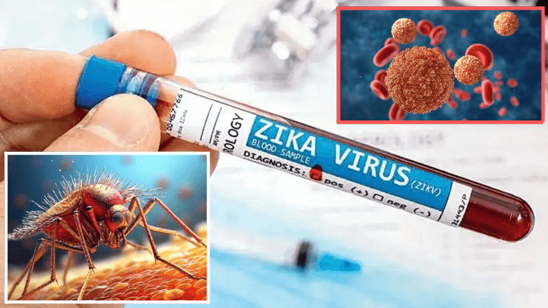 Zika ভাইরাসের দাপট বাড়ছে ভারতে