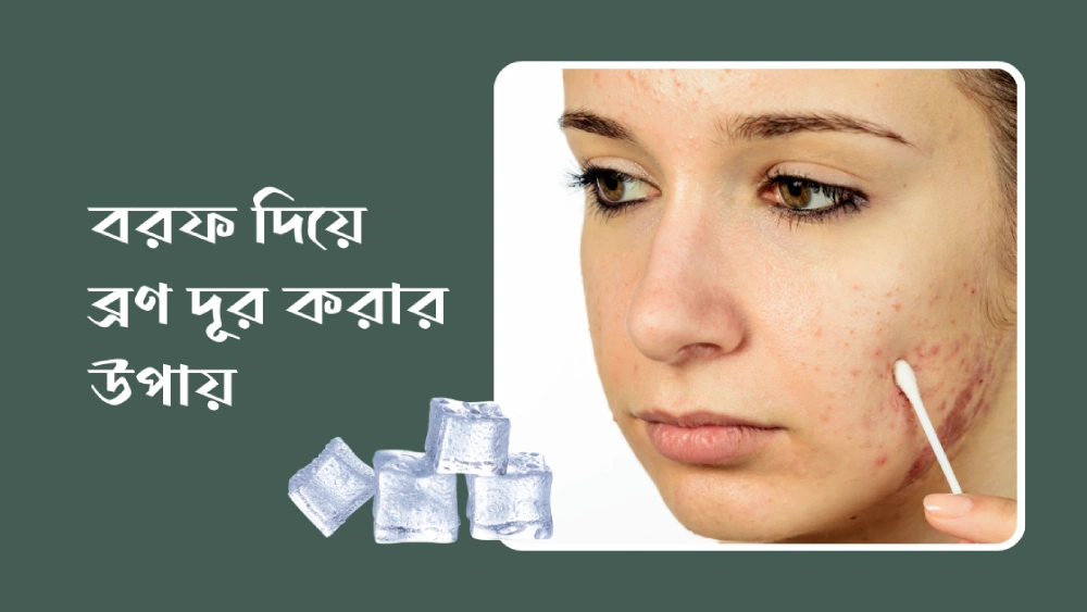 বরফ-দিয়ে-ব্রণ-দূর-করার-উপায়