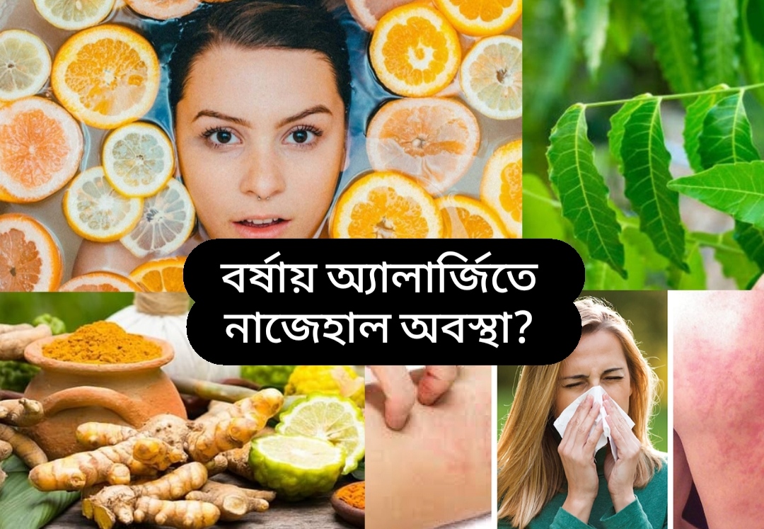 বর্ষায় অ্যালার্জিতে নাজেহাল অবস্থা?