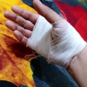 325+হাতে ব্যান্ডেজ করা ছবি ডাউনলোড , Hand bandage pictures