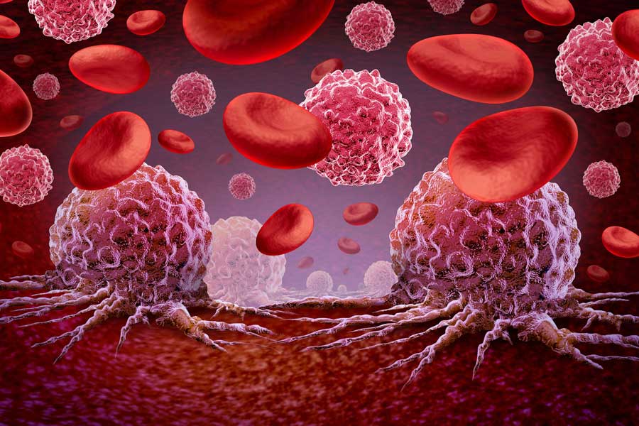 Blood Cancer মুছে দেবে ট্যাবলেট! ভারতে আসছে যুগান্তকারী ওষুধ, জানুন দাম রক্তের ক্যান্সার - এই নামটি শুনলেই একটা চাপা আতঙ্ক গ্রাস করে। একটা সময় ছিল যখন রক্তের ক্যান্সার মানেই এক নিশ্চিত পরিণতি মনে করা হতো। বিশেষ করে ক্রনিক মায়েলয়েড লিউকেমিয়া-এর মতো আগ্রাসী ক্যান্সার, যা অস্থিমজ্জা থেকে দ্রুত রক্তে ছড়িয়ে পড়ে এবং প্রায়শই চতুর্থ পর্যায়ে ধরা পড়ে, তা ছিল ভীতিকর। কিন্তু বিজ্ঞানের অগ্রগতি এখন সেই চিত্র বদলে দিচ্ছে। এবার সুখবর হলো, ট্যাবলেট খেলেই রক্ত ক্যান্সার নির্মূল করার একটি যুগান্তকারী ওষুধ ভারতে আসছে! এই যুগান্তকারী ওষুধটি তৈরি করেছে গ্লেনমার্ক ফার্মাসিউটিক্যালস, যাদের গবেষণাগার ভারতেও রয়েছে। সংস্থার দাবি, ভারতীয় রোগীদের শারীরিক গঠন ও প্রয়োজন বুঝে এই ওষুধটি একটি নতুন ফর্মুলায় তৈরি করা হয়েছে। নির্দিষ্ট ডোজে এই ট্যাবলেট সেবন করলে ক্যান্সার কোষের বৃদ্ধি ও বিভাজন থেমে যাবে বলে তারা আশা করছেন। জ়ানুব্রুটিনিব: এক নতুন আশার আলো অনেক বছর ধরে রক্তের ক্যান্সারের চিকিৎসায় রেডিওথেরাপি, কেমোথেরাপি, ইমিউনোথেরাপি এবং মোনোক্লোনাল অ্যান্টিবডির মতো পদ্ধতিগুলো ব্যবহৃত হয়ে আসছে। কিন্তু লিউকেমিয়ার চিকিৎসায় খাওয়ার ওষুধের তেমন প্রচলন ছিল না। গ্লেনমার্ক ফার্মাসিউটিক্যালস এই অভাব পূরণ করে 'জ়ানুব্রুটিনিব' নামের একটি ট্যাবলেট বাজারে আনছে, যা 'ব্রুকিনসা' ব্র্যান্ড নামে বিক্রি হবে। এই ওষুধটির ক্লিনিক্যাল ট্রায়াল দীর্ঘ সময় ধরে চলছিল এবং এর ফলাফল আশাব্যঞ্জক বলে দাবি করা হয়েছে। ক্যান্সার আক্রান্ত রোগীদের ওপর এর প্রয়োগে ইতিবাচক ফল পাওয়া গেছে। ট্রায়ালের রিপোর্ট পর্যালোচনা করে কেন্দ্রীয় ড্রাগ নিয়ামক সংস্থা ওষুধটির উৎপাদন ও বিক্রির অনুমোদন দিয়েছে। কিভাবে কাজ করবে এই ওষুধ? ক্রনিক মায়েলয়েড লিউকেমিয়া হলো এক ধরনের শ্বেত রক্তকণিকার ক্যান্সার। অস্থিমজ্জার স্টেম কোষ থেকে রক্তকণিকা তৈরি হয়। যখন এই কোষগুলোর অস্বাভাবিক ও অনিয়ন্ত্রিত বৃদ্ধি ঘটে, তখন তা ক্যান্সারের রূপ নেয়। মায়েলয়েড কোষের অনিয়ন্ত্রিত বৃদ্ধি ক্যান্সার কোষে রূপান্তরিত হয়। এই মায়েলয়েড কোষ থেকেই লোহিত কণিকা, শ্বেত রক্তকণিকা এবং অণুচক্রিকা তৈরি হয়। ফলে, মায়েলয়েড কোষ যদি লাগামছাড়াভাবে বিভাজিত হতে থাকে, তাহলে রক্ত কণিকা তৈরির প্রক্রিয়াও ব্যাহত হয়। শ্বেত রক্তকণিকার সংখ্যা অস্বাভাবিক হারে বাড়তে থাকে এবং অস্থিমজ্জায় জমা হয়, যা রক্তের মাধ্যমে সারা শরীরে ছড়িয়ে পড়ে। গবেষকদের দাবি, নতুন এই ওষুধটি ক্যান্সার কোষের এই বিস্তারকে ঠেকাতে সক্ষম হবে। দাম কত হতে পারে? দেশের বাজারে 'জ়ানুব্রুটিনিব'-এর এক বাক্সের দাম ২০ হাজার থেকে আড়াই লাখ টাকার মধ্যে হতে পারে। কোন কোম্পানি ওষুধটি বিক্রি করবে তার ওপর নির্ভর করে এই দাম পরিবর্তিত হবে। একটি বাক্সে ৮০ মিলিগ্রাম ডোজের প্রায় ১২০টি ট্যাবলেট থাকবে। অনকোলজিস্ট শুভদীপ চক্রবর্তী এক প্রতিবেদনে জানিয়েছেন, ক্রনিক মায়েলয়েড লিউকেমিয়া যতই ভয়ঙ্কর হোক না কেন, সঠিক সময়ে রোগ চিহ্নিত করতে পারলে রোগীর বেঁচে থাকার সম্ভাবনা বাড়ে। তার মতে, ক্যান্সার প্রায়শই এতটাই দেরিতে ধরা পড়ে যে তখন চিকিৎসাতেও তেমন কাজ হয় না। BCR-ABL জিনে রাসায়নিক পরিবর্তনের ফলেই ক্যান্সারের ঝুঁকি বাড়ে। নতুন এই ওষুধ ক্যান্সার কোষ নির্মূল করতে কতটা কার্যকরী হবে, তা আরও পরীক্ষা-নিরীক্ষার পরেই বোঝা যাবে।