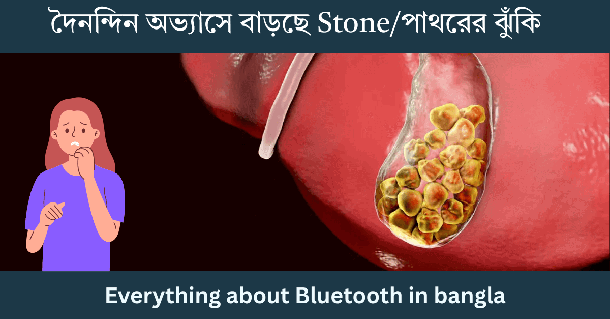 How To Stop Kidney Stones / Gallstones explained in bangla