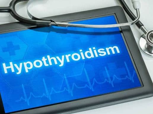 হাইপোথাইরয়েডিজম